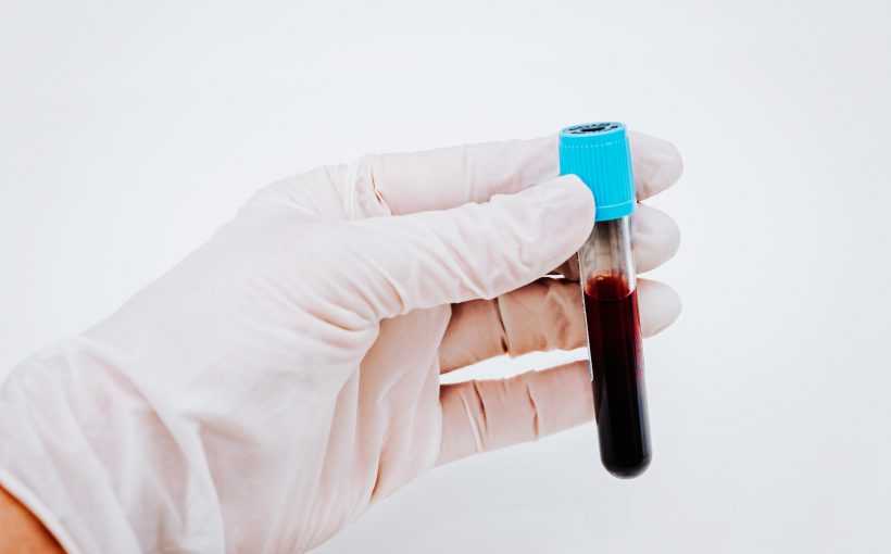 Analityk laboratoryjny trzyma w dłoni fiolkę wypełnioną krwią. /Źródło: 123rf.com