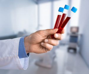 Analityk laboratoryjny trzyma w dłoni trzy probówki wypełnione krwią pacjenta. /Źródło: 123rf.com