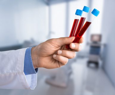 Analityk laboratoryjny trzyma w dłoni trzy probówki wypełnione krwią pacjenta. /Źródło: 123rf.com