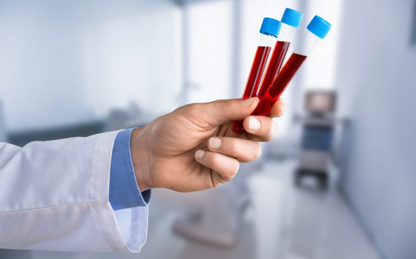 Analityk laboratoryjny trzyma w dłoni trzy probówki wypełnione krwią pacjenta. /Źródło: 123rf.com