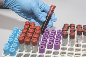  wawer badania krwi warszawa laboratorium