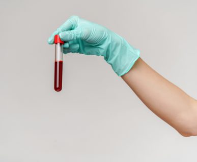 Pielęgniarka trzyma w dłoni odzianej w sterylną rękawiczkę, probówkę wypełnioną krwią. /Źródło: 123rf.com