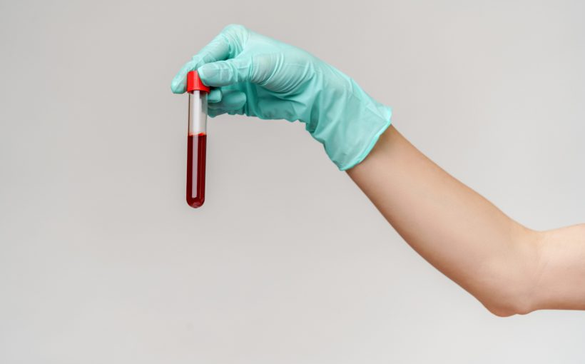 Pielęgniarka trzyma w dłoni odzianej w sterylną rękawiczkę, probówkę wypełnioną krwią. /Źródło: 123rf.com