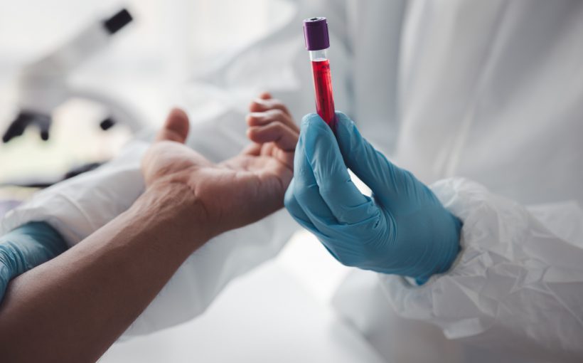 Pielęgniarz trzyma w dłoni probówkę wypełnioną krwią pacjenta, po pobraniu jej pacjentowi. /Źródło: 123rf.com