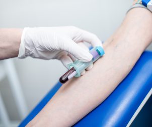 Pielęgniarka pobiera pacjentowi krew z żyły u ręki. /Źródło: 123rf.com
