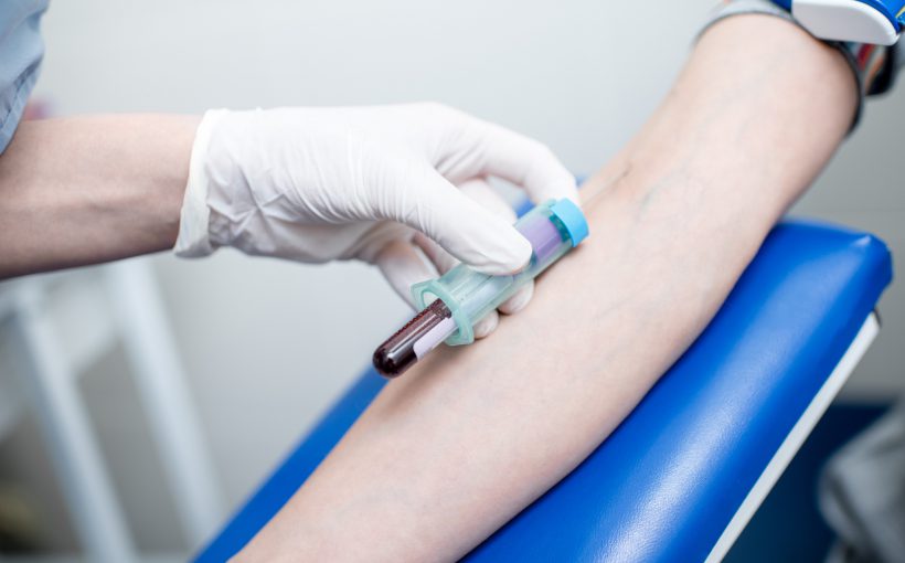 Pielęgniarka pobiera pacjentowi krew z żyły u ręki. /Źródło: 123rf.com