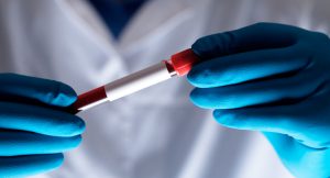 Analityk medyczny w białym fartuchu trzyma w dłoniach odzianych w sterylne rękawiczki, fiolkę wypełnioną krwią do celu diagnostyki laboratoryjnej. /Źródło: 123rf.com