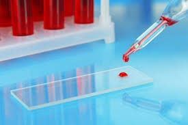 żychlin badania krwi, cennik laboratorium