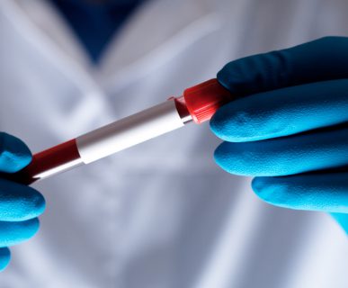 Analityk medyczny trzyma w dłoni odzianej w sterylne, jednorazowe rękawiczki, probówkę wypełniona próbką krwi. /Źródło: 123rf.com