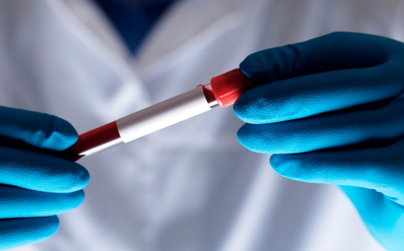 Analityk medyczny trzyma w dłoni odzianej w sterylne, jednorazowe rękawiczki, probówkę wypełniona próbką krwi. /Źródło: 123rf.com