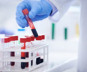 Analityk laboratoryjny odkłada poddaną już diagnostyce medycznej probówkę wypełnioną krwią. /Źródło: 123rf.com