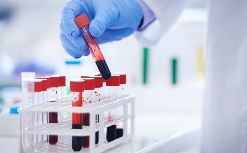 Analityk laboratoryjny odkłada poddaną już diagnostyce medycznej probówkę wypełnioną krwią. /Źródło: 123rf.com