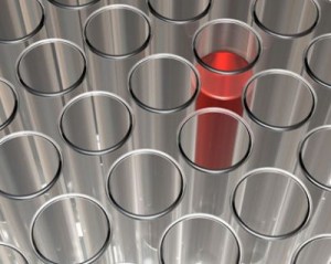 badania_laboratoryjne_krwi_mielec_osiedle_kopernika