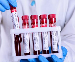 Pielęgniarz w sterylnym stroju trzyma w dłoniach odzianych w jednorazowe rękawiczki, probówki wypełnione krwią pacjentów. /Źródło: 123rf.com