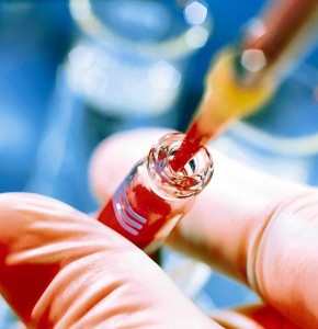 badania laboratoryjne krwi rzeszów wilkowyja