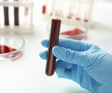 Analityk medyczny trzyma w dłoni probówkę wypełnioną krwią. /Źródło: 123rf.com