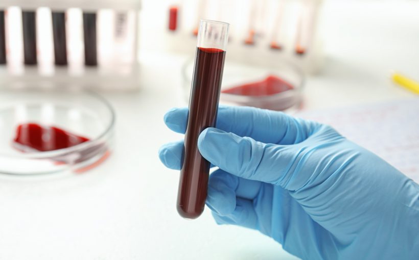 Analityk medyczny trzyma w dłoni probówkę wypełnioną krwią. /Źródło: 123rf.com