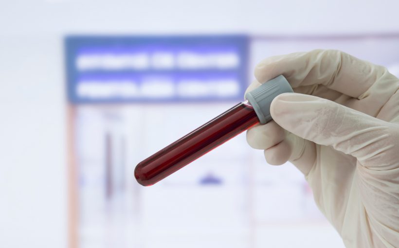 Pielęgniarka po pobraniu krwi trzyma w dłoni probówkę aby sprawdzić czy nie wytworzył się skrzep. /Źródło: 123rf.com