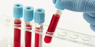 badania laboratoryjne krwi siedlce