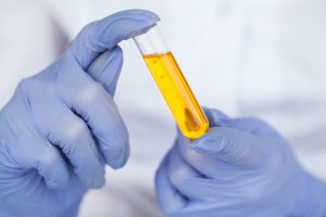 Analityk laboratoryjny trzyma w dłoni próbkę z moczem. /Źródło: 123rf.com