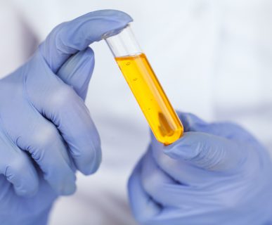 Analityk laboratoryjny trzyma w dłoni próbkę z moczem. /Źródło: 123rf.com