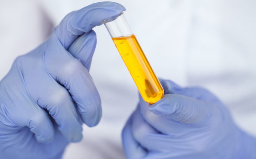 Analityk laboratoryjny trzyma w dłoni próbkę z moczem. /Źródło: 123rf.com