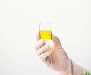Analityk medyczny trzyma w dłoni odzianej w rękawiczkę próbkę moczu. /Źródło: 123rf.com