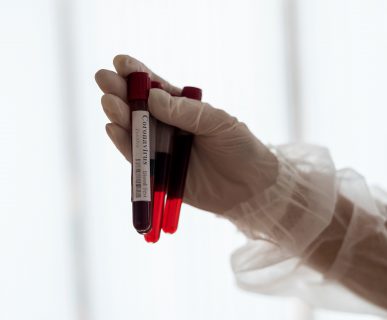 Analityk laboratoryjny w sterylnym stroju trzyma w dłoni trzy probówki wypełnione krwią pobraną w celu diagnostyki. /Źródło: 123rf.com