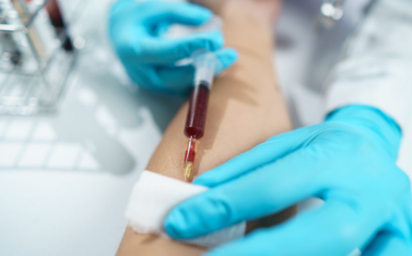 Pielęgniarka w sterylnych warunkach pobiera pacjentowi krew z żyły u zgięcia łokcia. /Źródło: 123rf.com