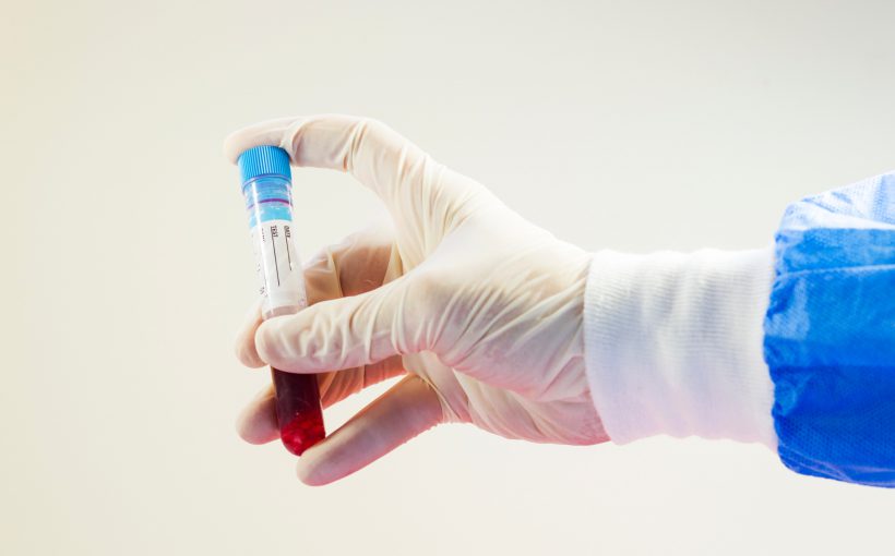 Analityk medyczny w sterylnym stroju trzyma w dłoni probówkę wypełnioną krwią. /Źródło: 123rf.com