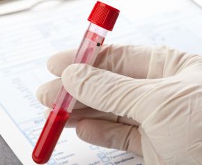 gliwice badania krwi, cennik laboratorium