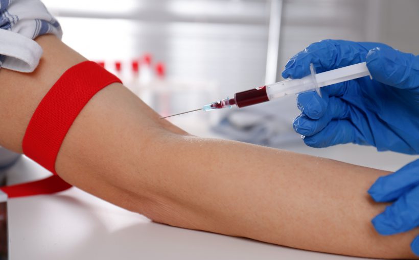 Pielęgniarka pobiera pacjentowi krew z żyły u ręki, na której założona jest opaska uciskowa. /Źródło: 123rf.com