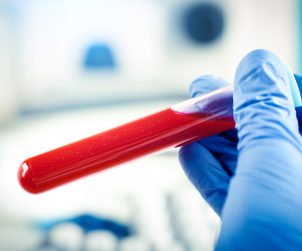 Analityk laboratoryjny trzyma w dłoni probówkę wypełnioną jasnoczerwoną krwią. /Źródło: 123rf.com