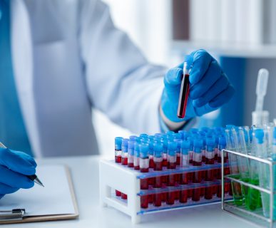 Analityk laboratoryjny trzyma w dłoni fiolkę wypełnioną krwią i opisuje jej właściwości. /Źródło: 123rf.com
