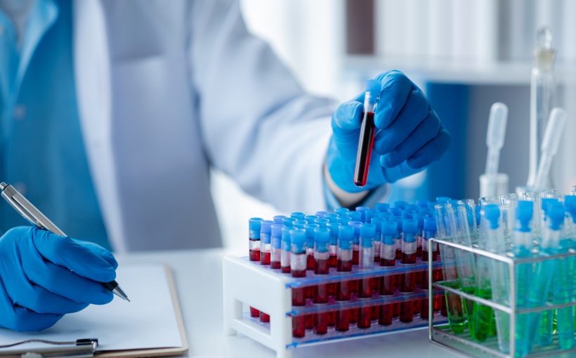 Analityk laboratoryjny trzyma w dłoni fiolkę wypełnioną krwią i opisuje jej właściwości. /Źródło: 123rf.com