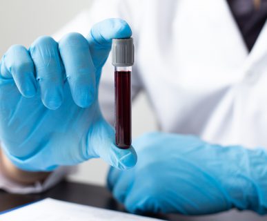 Analityk laboratoryjny trzyma w dłoni probówkę wypełnioną gęstą, ciemną krwią. /Źródło: 123rf.com