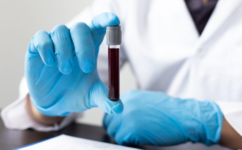Analityk laboratoryjny trzyma w dłoni probówkę wypełnioną gęstą, ciemną krwią. /Źródło: 123rf.com