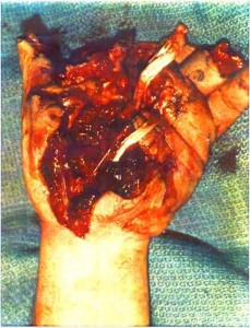 injury4