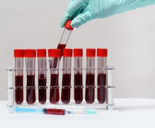 Pielęgniarka po pobraniu krwi odkłada probówkę z próbką materiału do specjalnego organizera. /Źródło: 123rf.com