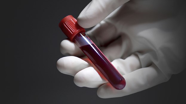 badanie krwi skórzewo laboratorium