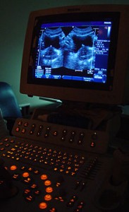 badanie usg łódź śródmieście, ultrasonografia, usg łódź
