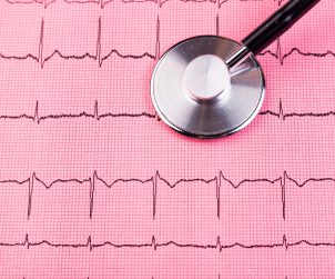 Zapis badania EKG, stetoskop. /Źródło: 123rf.com
