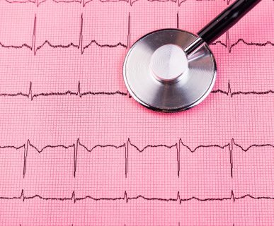 Zapis badania EKG, stetoskop. /Źródło: 123rf.com