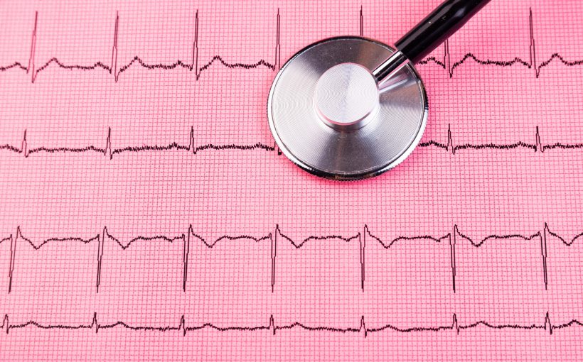 Zapis badania EKG, stetoskop. /Źródło: 123rf.com