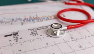 Wynik badania EKG z położonym na nim stetoskopem. /Źródło: 123rf.com