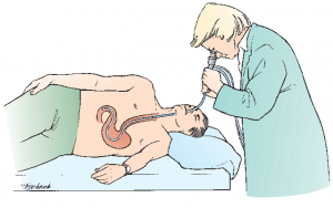 gastroskopia łódź, pracownia gastroskopii, pracownia endoskopii, pracownia endoskopowa w łodzi, badanie gastroskopi , gastrolog, gastroenterolog