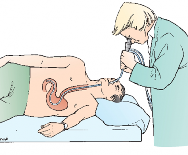 gastroskopia łódź, pracownia gastroskopii, pracownia endoskopii, pracownia endoskopowa w łodzi, badanie gastroskopi , gastrolog, gastroenterolog