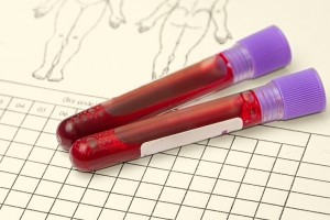Badania laboratoryjne krwi Skarżysko Kamienna