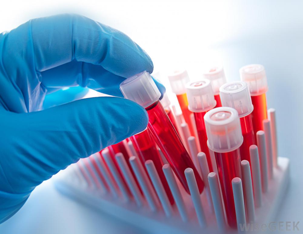 Www Knurow Laboratorium Pl Wyniki Badanie krwi Rybnik laboratorium. Cennik badań, wyniki. | Badania