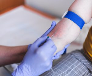 Pielęgniarka pobiera pacjentowi krew z wyraźnie widocznej żyły. /Źródło: 123rf.com